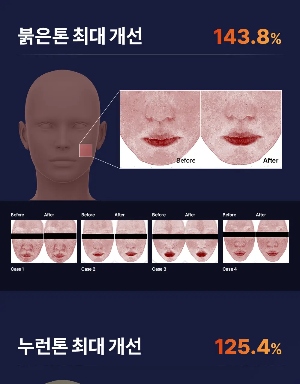 [순수비타민C/잡티앰플] 마미케어 오쏘타민 비타민C 앰플 15ml 상세페이지 24